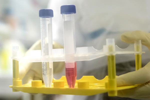 'Tüm şüpheli hastalara test yapmak zorundasınız!'