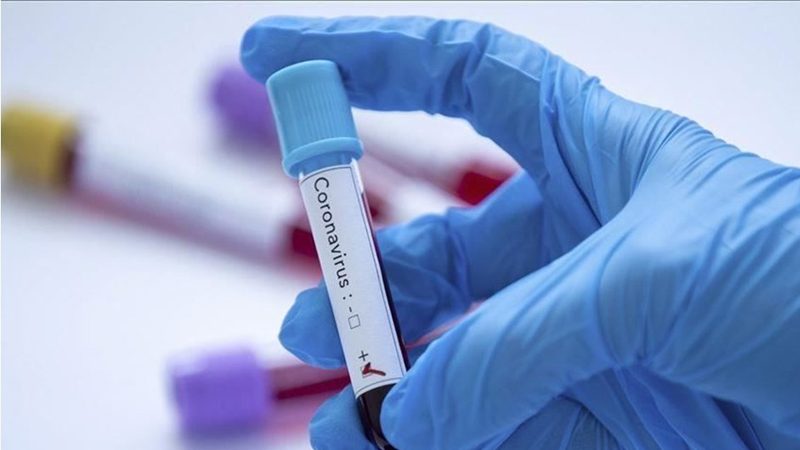 Güney Kıbrıs'ta bugüne kadar 4 bin Kovit-19 testi yapıldı