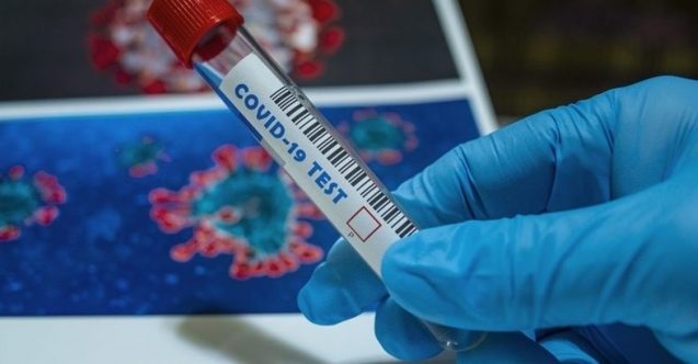 Güney Kıbrıs’ta son 24 saatte 3 yeni vaka daha tespit edildi