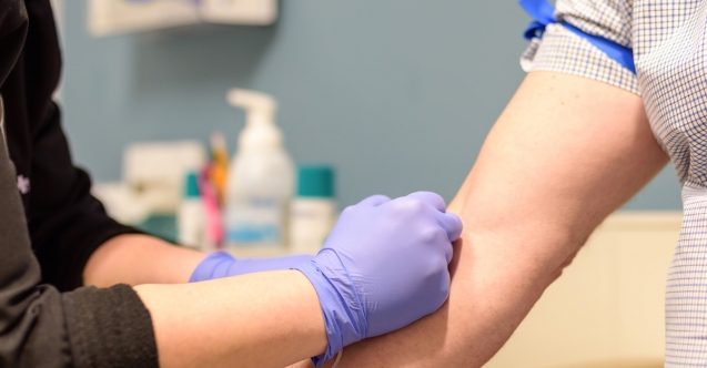 KKTC'de 88 AIDS hastası var