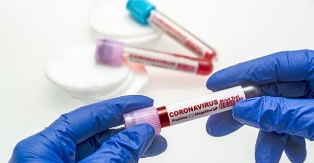 179 yeni vaka