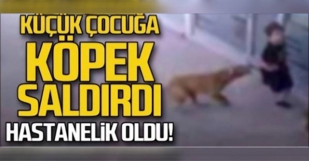 Limasol'da iki yaşındaki çocuğa köpek saldırdı
