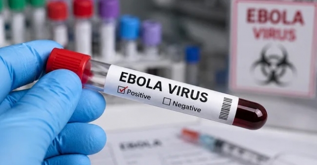Doktorlardan Ebola salgınına karşı ulusal eylem planı çağrısı